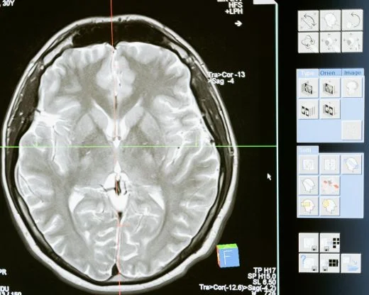 la inteligencia artificial en la medicina ayuda en la big data